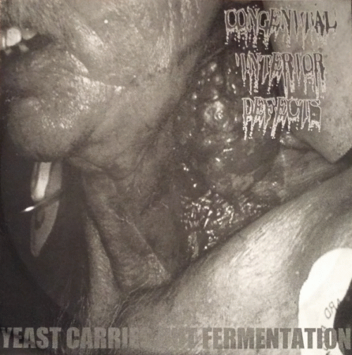 Congenital Interior Defects : Yeast Carries Out Fermentation Congenital Interior Defects : Yeast Carries Out Fermentation